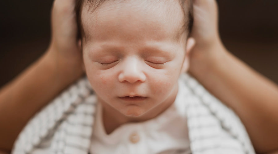 Newborn baby with baby acne